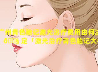 广州青色胎记激光治疗费用由何决 🐧 定「激光治疗青色胎记大概多少钱」